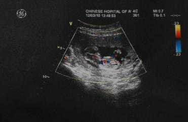 dna微信香港验血,二胎成功备孕男宝，准到爆的症状和备孕经验，儿女双全百接